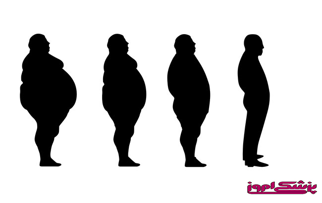 لاغری| رژیم غذایی| دارو| وزن| ونوستات| بررسی یک پژوهش علمی روی داروی لاغری ونوستات